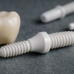 Zirconia Dental Implants 2025–2030: Disruptive Growth & Biocompatibility Revolution